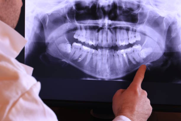 Best Urgent Care for Lost Fillings or Crowns in York, PA
